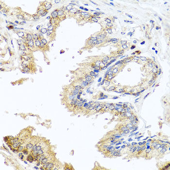 Immunofluorescence analysis of U2OS cells using DAPK2 Polyclonal Antibody at dilution of  1:100. Blue: DAPI for nuclear staining.