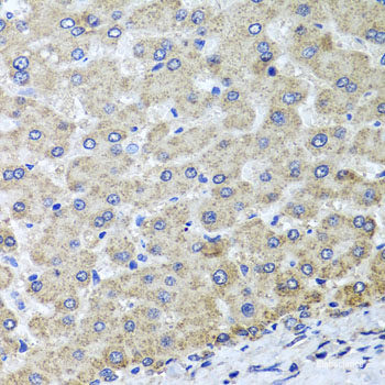 Immunohistochemistry of paraffin-embedded Human prostate using HPSE2 Polyclonal Antibody at dilution of  1:100 (40x lens).