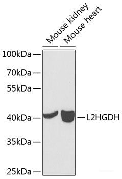 Immunohistochemistry of paraffin-embedded Human gastric using TAZ Polyclonal Antibody at dilution of  1:200 (40x lens).