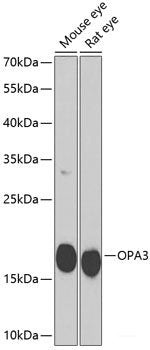 Immunofluorescence analysis of U2OS cells using PNKD Polyclonal Antibody at dilution of  1:100. Blue: DAPI for nuclear staining.