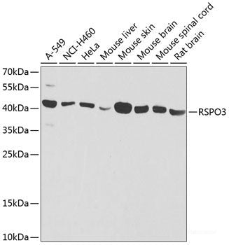 Immunohistochemistry of paraffin-embedded Mouse stomach using IER3 Polyclonal Antibody at dilution of  1:100 (40x lens).