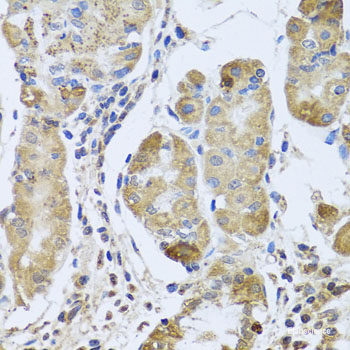 Immunohistochemistry of paraffin-embedded Human prostate using SOST Polyclonal Antibody at dilution of  1:100 (40x lens).
