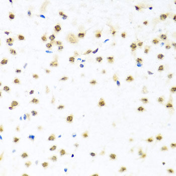 Immunohistochemistry of paraffin-embedded Rat lung using WNT5B Polyclonal Antibody at dilution of  1:100 (40x lens).