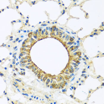 Immunohistochemistry of paraffin-embedded Mouse kidney using INADL Polyclonal Antibody at dilution of  1:100 (40x lens).