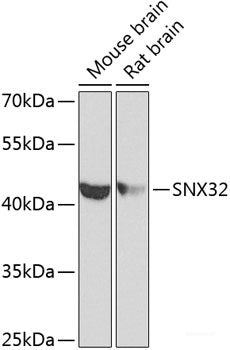 Immunohistochemistry of paraffin-embedded Human lung cancer using SEMA4C Polyclonal Antibody at dilution of  1:100 (40x lens).