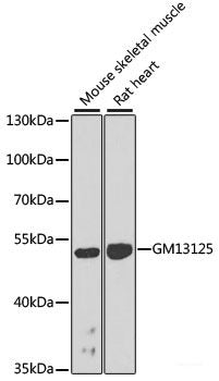 Immunohistochemistry of paraffin-embedded Human esophageal smooth muscle using MRPL12 Polyclonal Antibody at dilution of  1:100 (40x lens).