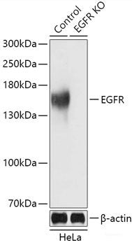 Immunohistochemistry of paraffin-embedded Rat liver using KAT2A Polyclonal Antibody at dilution of  1:100 (40x lens).
