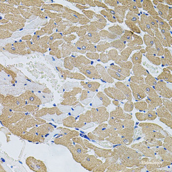 Immunofluorescence analysis of U-251MG cells using S100B Polyclonal Antibody at dilution of  1:100 (20x lens). Blue: DAPI for nuclear staining.