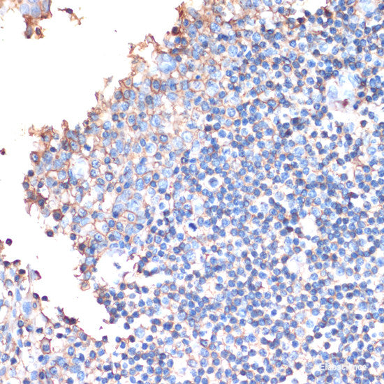 Immunohistochemistry of paraffin-embedded Rat heart using ARRB1 Polyclonal Antibody at dilution of  1:100 (40x lens).