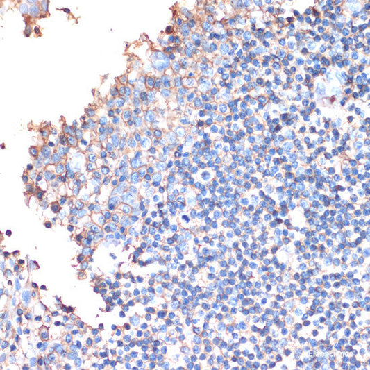 Immunohistochemistry of paraffin-embedded Rat heart using ARRB1 Polyclonal Antibody at dilution of  1:100 (40x lens).