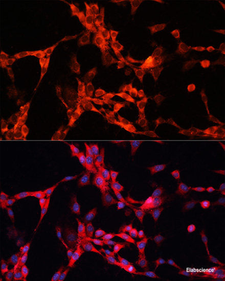 Immunohistochemistry of paraffin-embedded Human lung cancer using ART1 Polyclonal Antibody at dilution of  1:100 (40x lens).