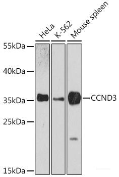 Immunofluorescence analysis of C6 cells using ADA Polyclonal Antibody at dilution of  1:100. Blue: DAPI for nuclear staining.