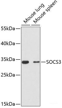 Immunofluorescence analysis of C6 cells using GOLGA4 Polyclonal Antibody at dilution of  1:100 (40x lens). Blue: DAPI for nuclear staining.