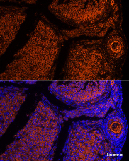 Immunohistochemistry of paraffin-embedded Rat brain using PRMT1 Polyclonal Antibody at dilution of  1:100 (40x lens).