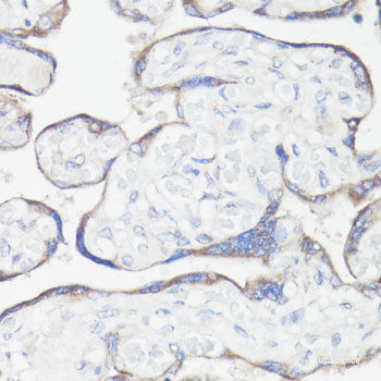 Immunohistochemistry of paraffin-embedded Human colon using MCM2 Polyclonal Antibody at dilution of  1:200 (40x lens).
