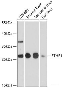 Immunohistochemistry of paraffin-embedded Rat brain using Slug Polyclonal Antibody at dilution of  1:100 (40x lens).