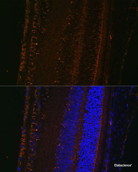 Immunohistochemistry of paraffin-embedded Human tonsil using CYBA Polyclonal Antibody at dilution of  1:100 (40x lens).