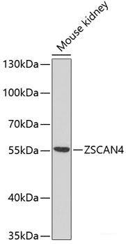 Immunofluorescence analysis of U2OS cells using HNRNPDL Polyclonal Antibody at dilution of  1:100. Blue: DAPI for nuclear staining.