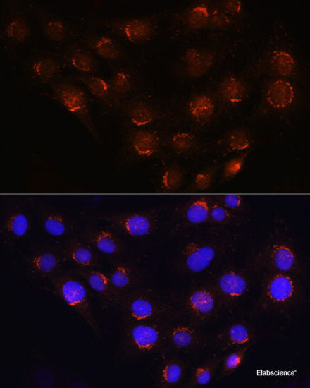 Immunohistochemistry of paraffin-embedded Rat spinal cord using HADH Polyclonal Antibody at dilution of  1:100 (40x lens).