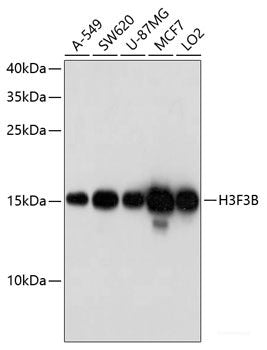 Immunohistochemistry of paraffin-embedded Human prostate using CUL3 Polyclonal Antibody at dilution of  1:100 (40x lens).