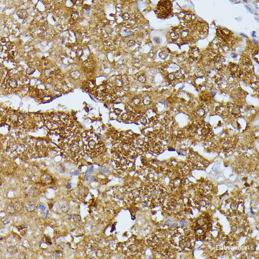 Immunohistochemistry of paraffin-embedded Mouse brain using ALPL Polyclonal Antibody at dilution of  1:100 (40x lens).