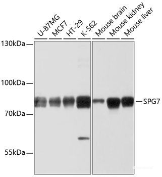 Immunohistochemistry of paraffin-embedded Human colon using FAM3B Polyclonal Antibody at dilution of  1:100 (40x lens).