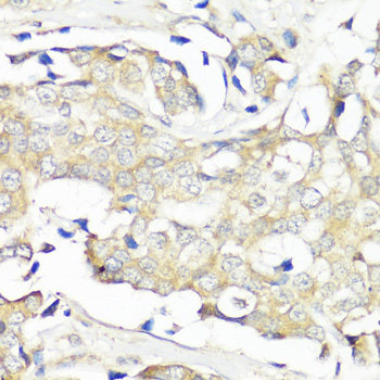 Immunohistochemistry of paraffin-embedded Human placenta using HSD17B1 Polyclonal Antibody at dilution of  1:100 (40x lens).