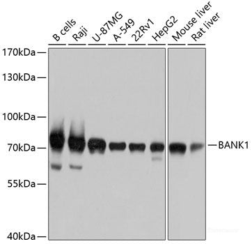 Western blot analysis of extracts of HCT116 cells using Bcl-2 Polyclonal Antibody at dilution of 1:1000. HCT116 cells treated with different concentRations of B7-H4.