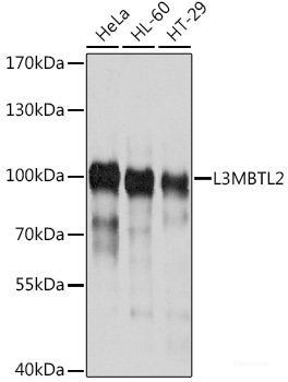 Immunofluorescence analysis of C6 cells using BRCA1 Polyclonal Antibody at dilution of  1:100. Blue: DAPI for nuclear staining.
