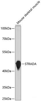 Immunohistochemistry of paraffin-embedded Human kidney cancer using BAG1 Polyclonal Antibody at dilution of  1:100 (40x lens).