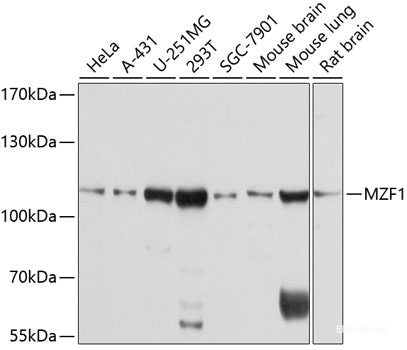 Western blot analysis of extracts of various cell lines using DNMT3B Polyclonal Antibody at dilution of 1:1000.