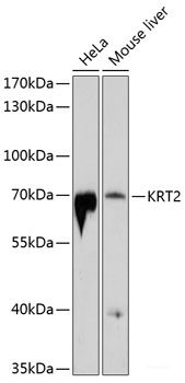 Immunohistochemistry of paraffin-embedded Rat lung using HO-1 Polyclonal Antibody at dilution of  1:200 (40x lens).