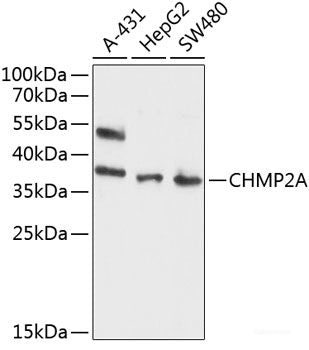 Immunohistochemistry of paraffin-embedded Rat spleen using IGFBP1 Polyclonal Antibody at dilution of  1:100 (40x lens).