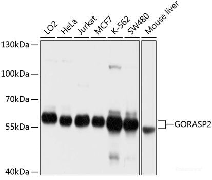 Immunofluorescence analysis of L929 cells using CYR61 Polyclonal Antibody at dilution of  1:100. Blue: DAPI for nuclear staining.