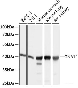 Immunohistochemistry of paraffin-embedded Rat testis using VEGF Receptor 2 Polyclonal Antibody at dilution of  1:100 (40x lens).