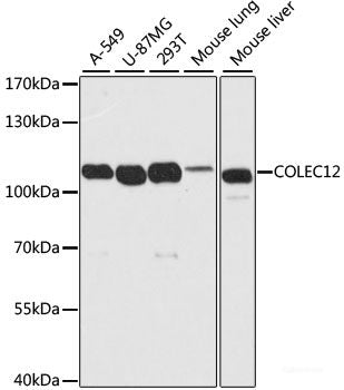 Immunofluorescence analysis of HeLa cells using DAZL Polyclonal Antibody at dilution of  1:100. Blue: DAPI for nuclear staining.