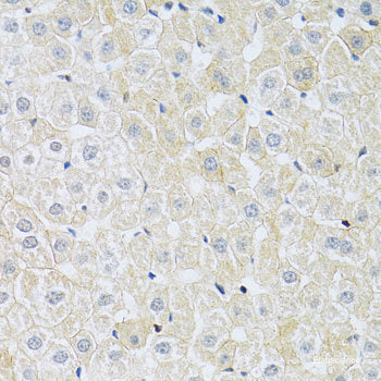 Immunohistochemistry of paraffin-embedded Mouse kidney using MMP9 Polyclonal Antibody at dilution of  1:100 (40x lens).
