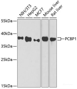 Immunohistochemistry of paraffin-embedded Mouse leydig cells using NRF2 Polyclonal Antibody at dilution of  1:100 (40x lens).