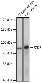 Immunohistochemistry of paraffin-embedded Mouse lung using TTR Polyclonal Antibody at dilution of  1:100 (40x lens).