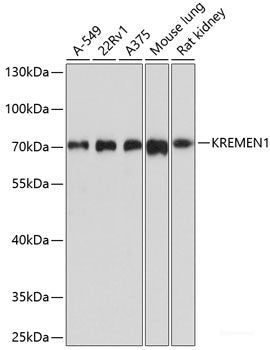 Immunohistochemistry of paraffin-embedded Human placenta using STAT3 Polyclonal Antibody at dilution of  1:200 (40x lens).