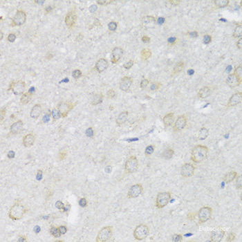 Immunohistochemistry of paraffin-embedded Human appendix using TLR4 Polyclonal Antibody at dilution of  1:100 (40x lens).