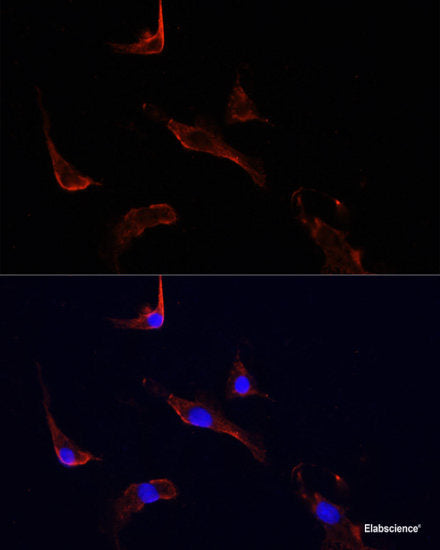 Immunohistochemistry of paraffin-embedded Rat lung using PHPT1 Polyclonal Antibody at dilution of  1:100 (40x lens).
