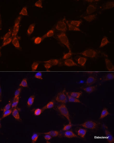 Immunohistochemistry of paraffin-embedded Mouse liver using MYC Polyclonal Antibody at dilution of  1:100 (40x lens).