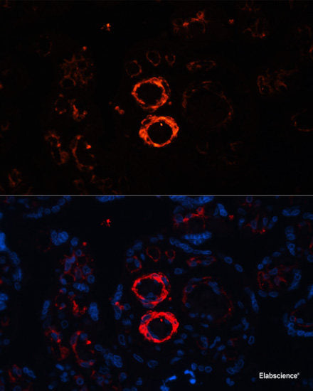 Immunohistochemistry of paraffin-embedded Rat kidney using ASC / TMS1 Polyclonal Antibody at dilution of  1:100 (40x lens).