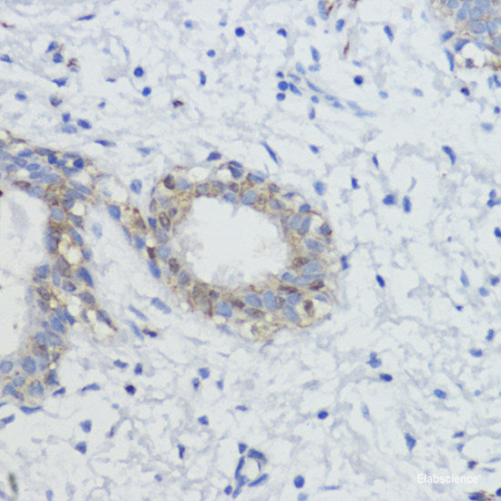 Immunohistochemistry of paraffin-embedded Mouse heart using MMP9 Polyclonal Antibody at dilution of  1:100 (40x lens).
