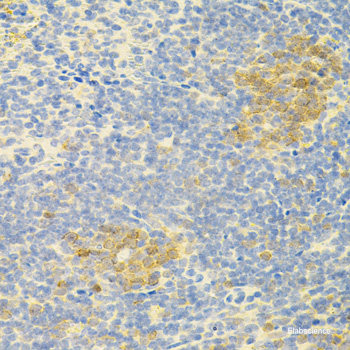 Immunohistochemistry of paraffin-embedded Rat lung using MTCO2 Polyclonal Antibody at dilution of  1:100 (40x lens).