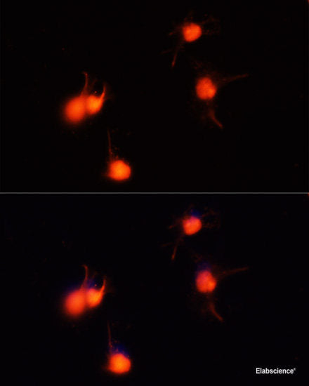 Immunohistochemistry of paraffin-embedded Human stomach using TNF-α Polyclonal Antibody at dilution of  1:100 (40x lens).