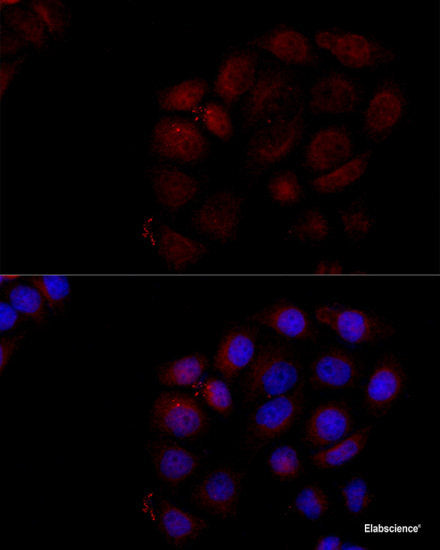 Immunohistochemistry of paraffin-embedded Rat liver using CHD4 Polyclonal Antibody at dilution of  1:100 (40x lens).