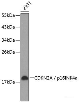 Immunohistochemistry of paraffin-embedded Human lung cancer using EGFR Polyclonal Antibody at dilution of  1:100 (40x lens).