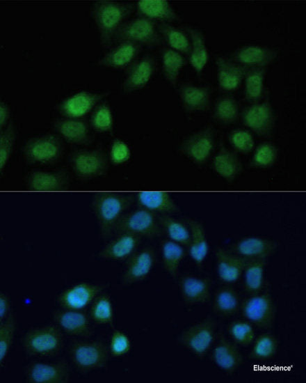 Immunohistochemistry of paraffin-embedded Human stomach using BCL2L2 Polyclonal Antibody at dilution of  1:100 (40x lens).